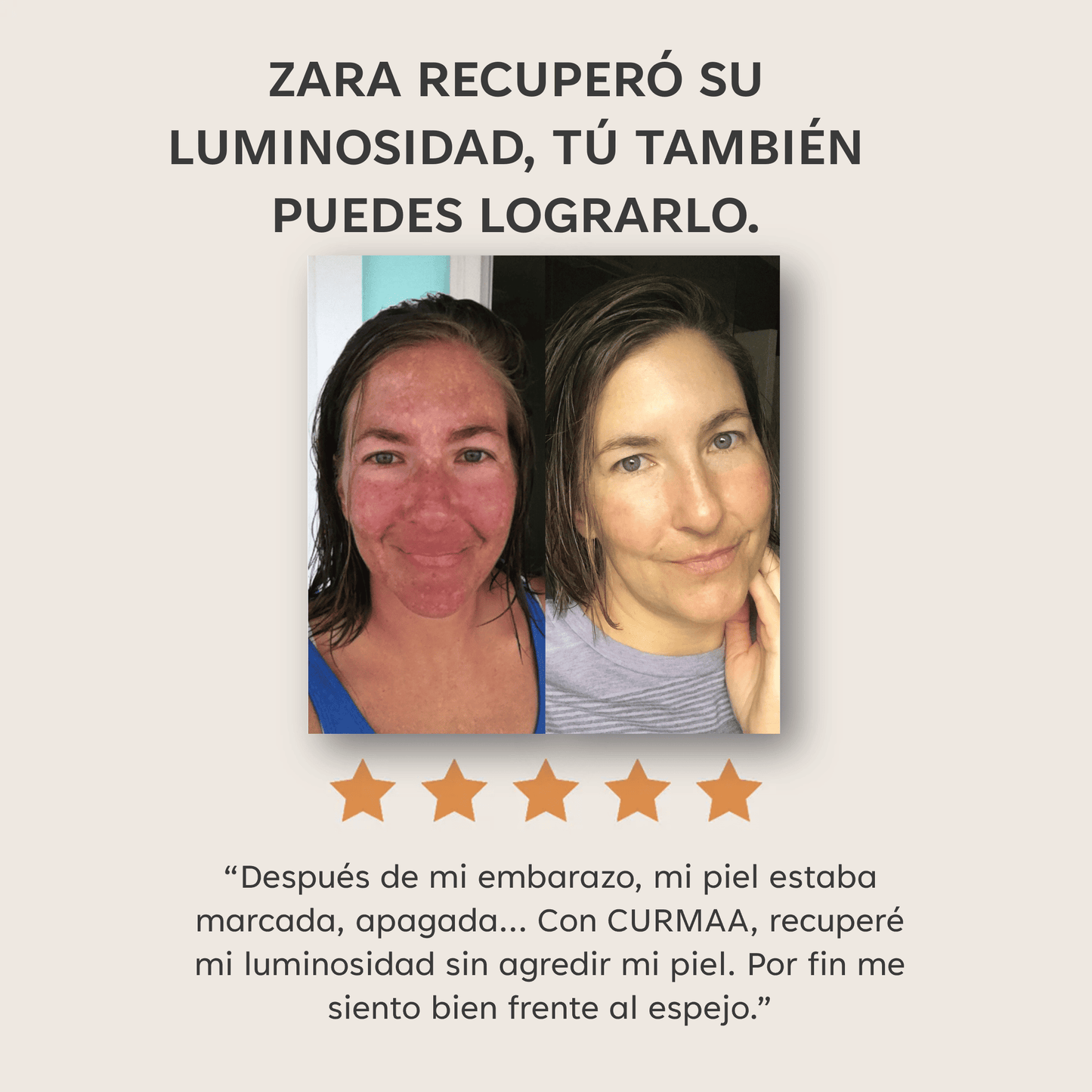 PADS ANTIMANCHAS CURCUMINA Y KÓJICO - 40 UNIDADES