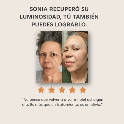 PADS ANTIMANCHAS CURCUMINA Y KÓJICO - 40 UNIDADES