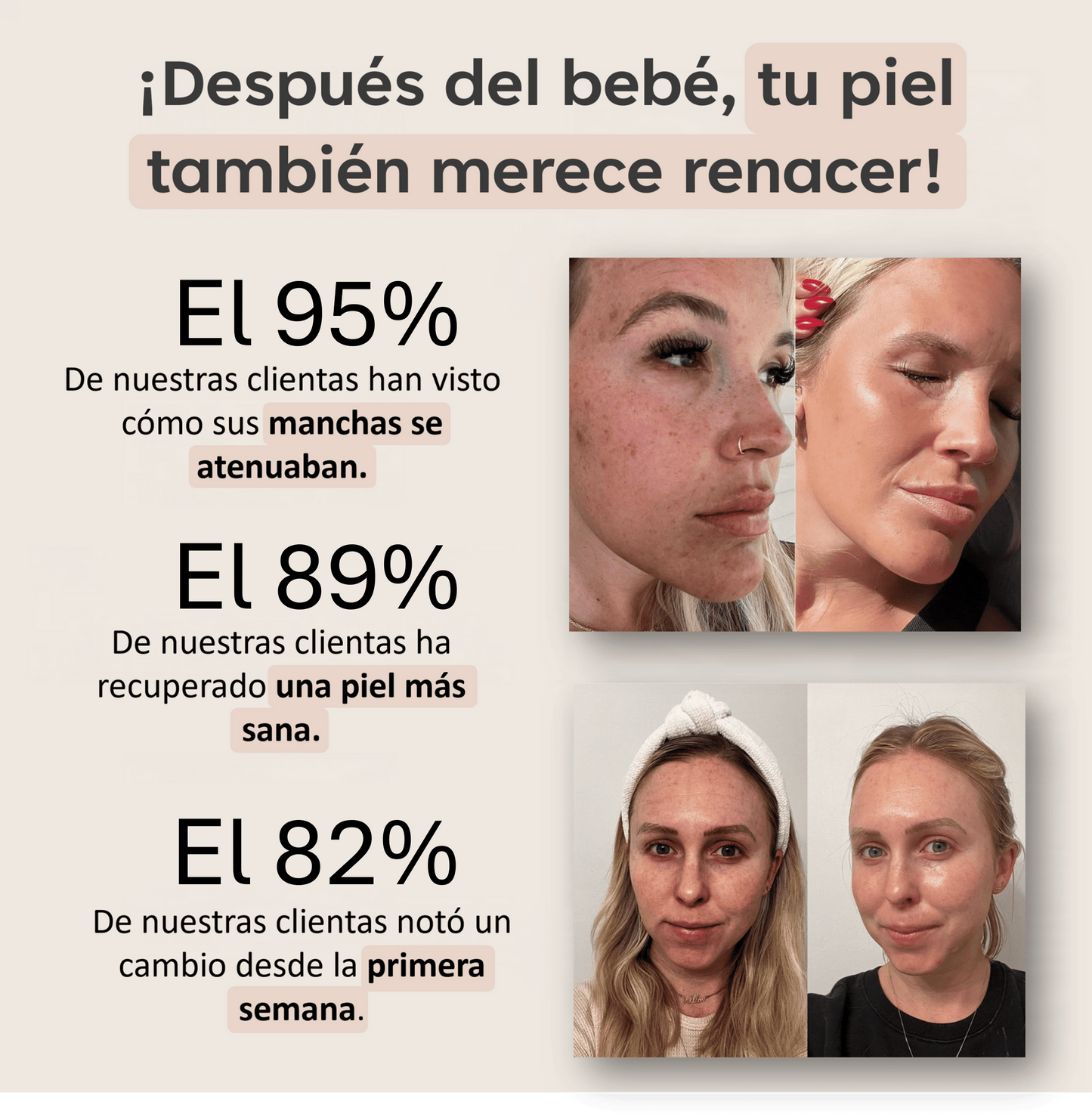 PADS ANTIMANCHAS CURCUMINA Y KÓJICO - 40 UNIDADES