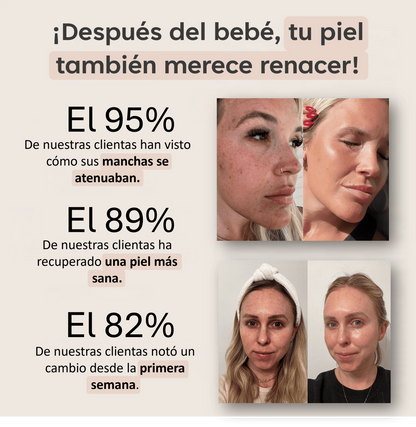 PADS ANTIMANCHAS CURCUMINA Y KÓJICO - 40 UNIDADES