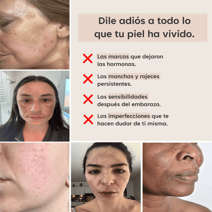 PADS ANTIMANCHAS CURCUMINA Y KÓJICO - 40 UNIDADES